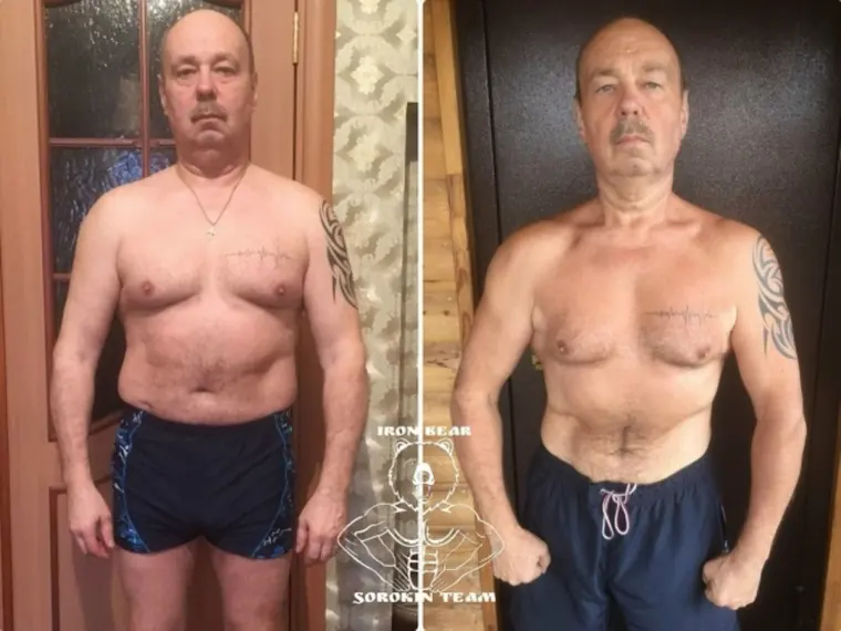 Андрей, 57: до и после